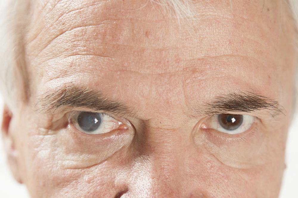 Tucson LASIK Eye Surgery Benefits