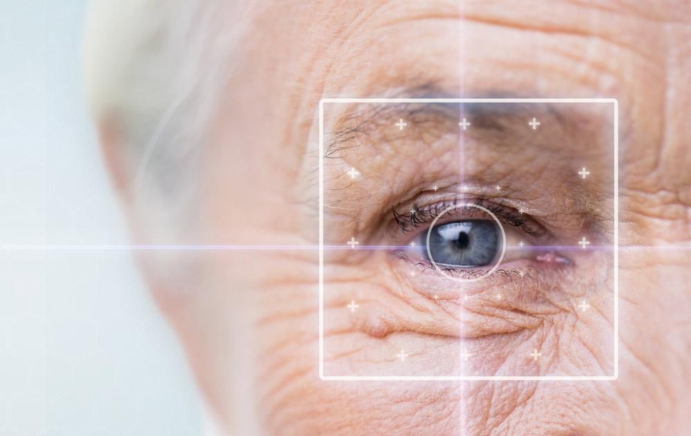 Glaucoma of the eye
