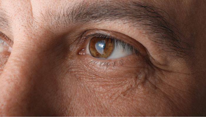 Cataract Surgery Pre & Post Op Care
